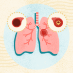 Asthma Symptoms, Causes, And Treatments