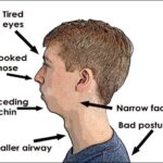 Myofunctional Therapy Mississauga