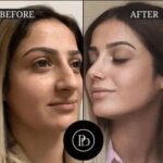 Real Results from the Best Plastic Surgeons in Dubai
