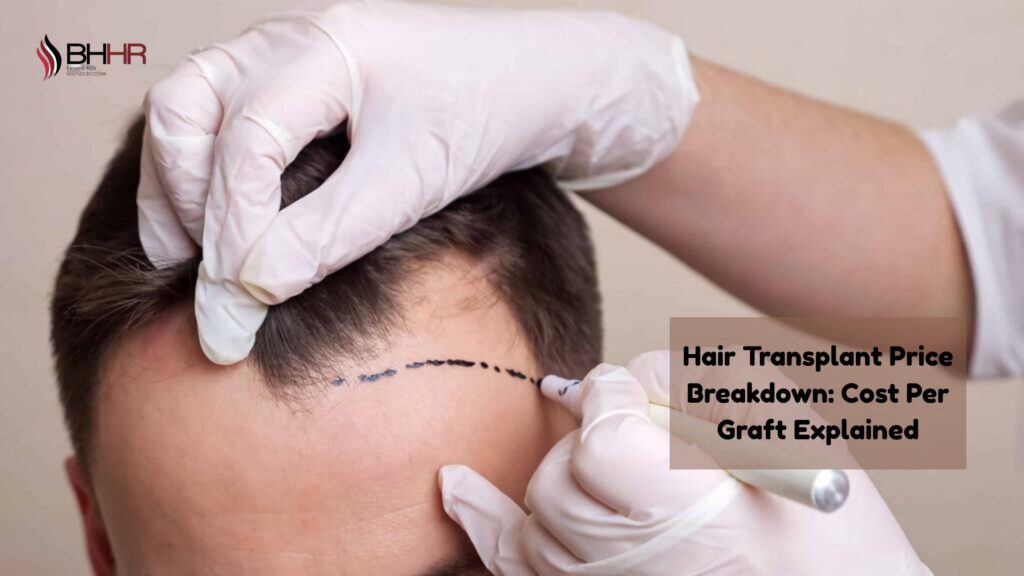 hair transplant price