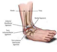 managing ligament strain with soma medicine