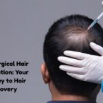 non surgical hair restoration