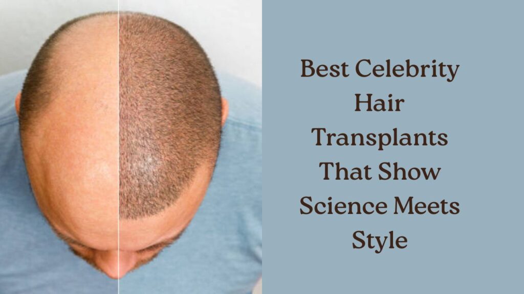 best celebrity hair transplants