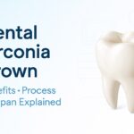 Dental Zirconia Crown Benefits, Process & Lifespan Guide
