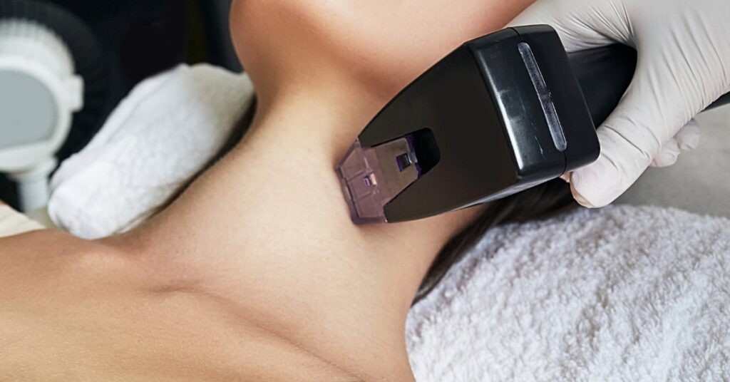 Morpheus Treatment: The Quiet Revolution in Skin Rejuvenation