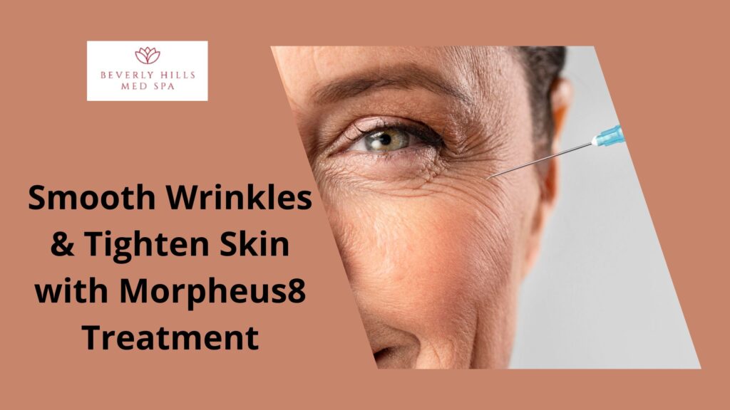 Smooth Wrinkles & Tighten Skin with Morpheus8 Treatment