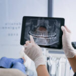 Mercury Free Dentistry in Aberdeen